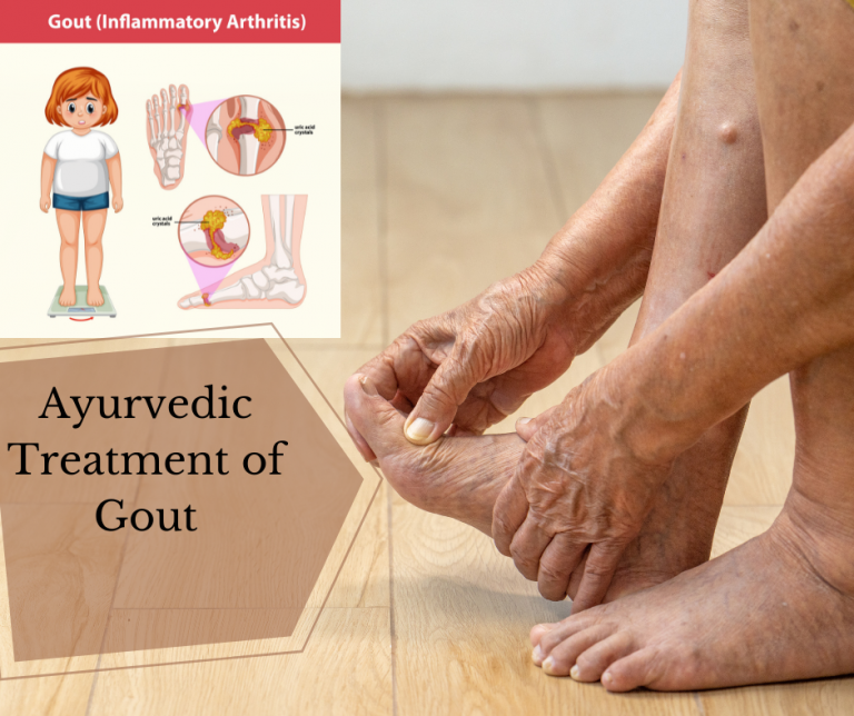 Ayurvedic treatment of Gout Aatreya Ayurved & Panchakarma Clinic
