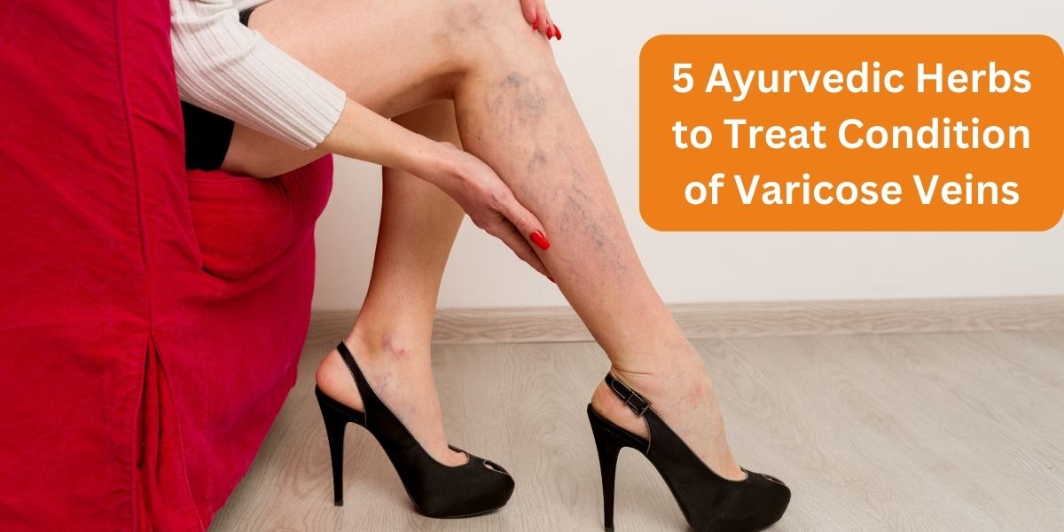 5 Ayurvedic Herbs to Treat Condition of Varicose Veins Dr. Dattraya Nalage